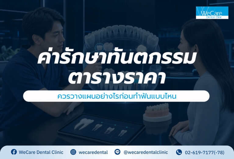 ค่ารักษาทันตกรรม : ตารางราคาและควรวางแผนอย่างไรก่อนทำฟันแบบไหน