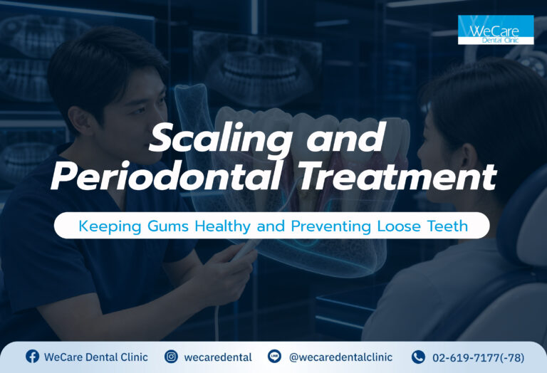 Scaling and Periodontal Treatment: Keeping Gums Healthy and Preventing Loose Teeth